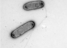  Plant bacteria, TEM Philips CM100, Bioscan 792, Magda Tušek Žnidarič.