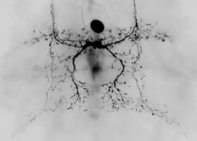 Insect vibratory interneuron (photo: M. Zorović)  Insect vibratory interneuron (photo: M. Zorović)
