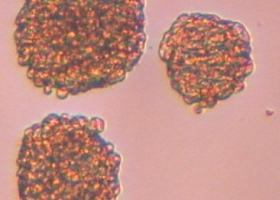 Glioblastoma stem cells grown in culture in the form of 3D aggregates, called spheroids (40x magnification). (photo: Dr. Neža Podergajs) 
					 Glioblastoma stem cells grown in culture in the form of 3D aggregates, called spheroids (40x magnification). (photo: Dr. Neža Podergajs)