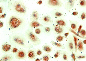  Osteoclasts stainined with anti-cathepsin K antibody and hematoxylin solution (200x magnification). (photo: Urška Verbovšek)