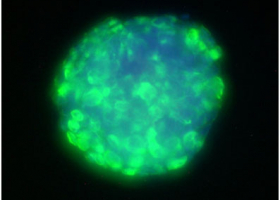  Glioblastoma stem cells derived spheroid, where a stem cell marker nestin is labeled with green fluorescence (100x magnification). (photo: Dr. Neža Podergajs)