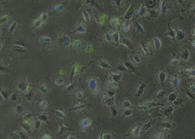  A549 cells labeled with aptamers (green fluorescence). (photo: Mateja Delač)
