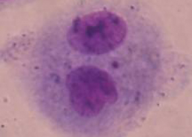 Binucleated cell with a micronucleus. (photo: Dr. Bojana Žegura  Binucleated cell with a micronucleus. (photo: Dr. Bojana Žegura