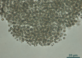  Cyanobacterium  Microcystis aeruginosa. (photo: Dr. Tina Eleršek)