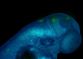 Fluorescent glioblastoma cells in the brain of a zebrafish embryo (photo: dr. Miloš Vittori)  Fluorescent glioblastoma cells in the brain of a zebrafish embryo (photo: dr. Miloš Vittori)