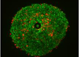  Quantification of live and dead cells in U87 derived spheroid, with a known number of cells. (photo: Dr. Monika Primon)