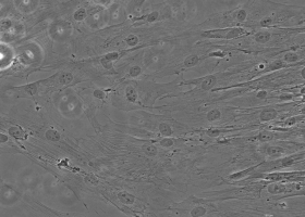  Bone marrow msenchymal stem cells (200x magnification). (Photo: Barbara Breznik)