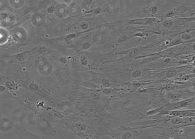 Bone marrow msenchymal stem cells (200x magnification). (Photo: Barbara Breznik)  Bone marrow msenchymal stem cells (200x magnification). (Photo: Barbara Breznik)