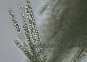 Potentially toxic cyanobacterium Aphanizomenon flos-Aqueena often occurs in Slovenia. (photo: Dr. Tina Eleršek)  Potentially toxic cyanobacterium Aphanizomenon flos-Aqueena often occurs in Slovenia. (photo: Dr. Tina Eleršek)