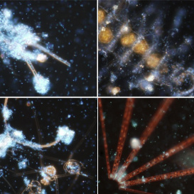Bacteria attached to plankton organisms