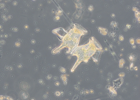  Two cells of the dinoflagellate Dinophysis tripos (photo: P. Mozetič) 