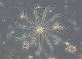  Terminal cell of the colony of diatom Bacteriastrum sp. (photo: P. Mozetič) 