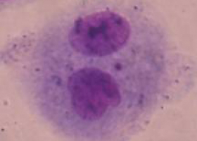  Binucleated cell with a micronucleus. (photo: Dr. Bojana Žegura
