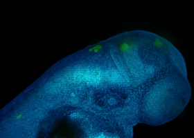  Fluorescent glioblastoma cells in the brain of a zebrafish embryo (photo: dr. Miloš Vittori)