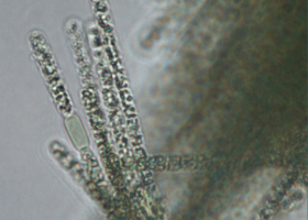  Potentially toxic cyanobacterium Aphanizomenon flos-Aqueena often occurs in Slovenia. (photo: Dr. Tina Eleršek)