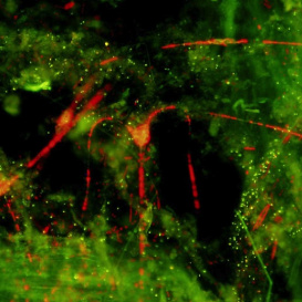 Phytoplanklankton sample