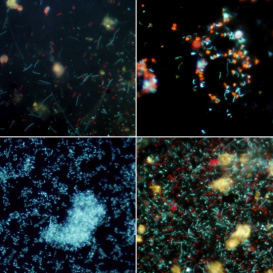 Different forms and density of marine bacteria