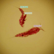 Measurements of harpacticoid copepods for biomass evaluation (stained with Rose Bengal)