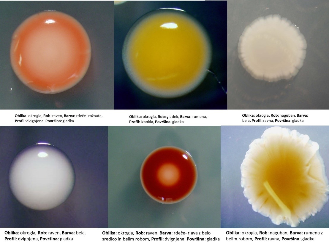 Opis morfoloških lastnosti kolonij nekaterih bakterijskih izolatov